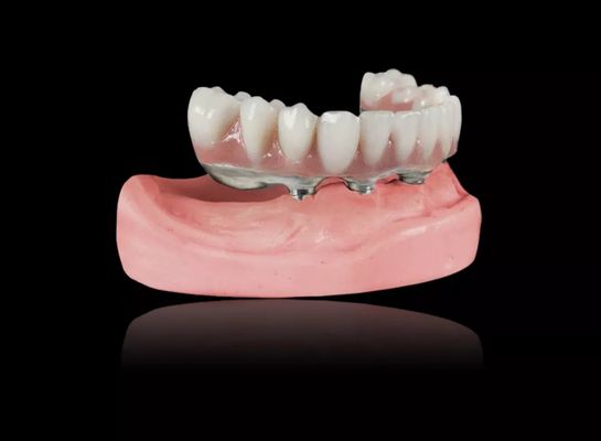 satın al İmplant Titanyum Çubuk Alınabilir Diş Dişleri Titanyum Alaşım İmplant Çubuk Aşırı Diş Dişleri online manufacture