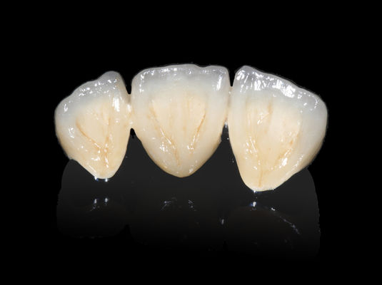 satın al İmplant Dental PFM Köprü Değersiz CAD CAM PFM Taç online manufacture