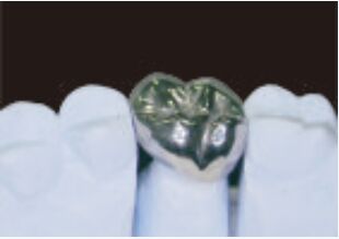 satın al Tam Metal Taç ve Köprü Yüksek Doğruluk Gümüş Geçici Taç online manufacture