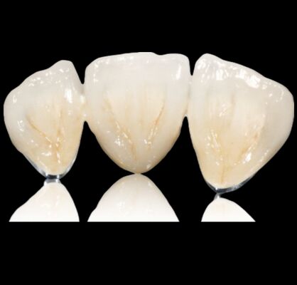 satın al Özelleştirilebilir Yarım Değerli Taç veya Köprü Değerli Alaşım Taç ve Köprü online manufacture