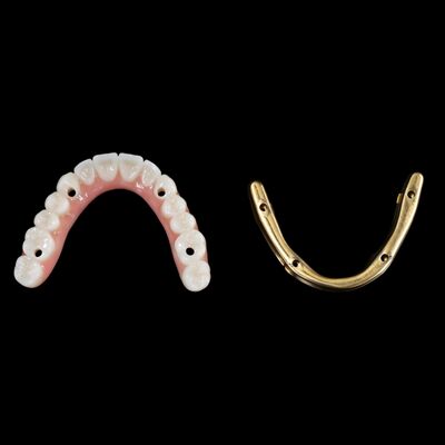satın al Hıbrit Diş İmplantlarını Özelleştir Titanyum Çubuklu Hıbrit Diş Dişleri online manufacture