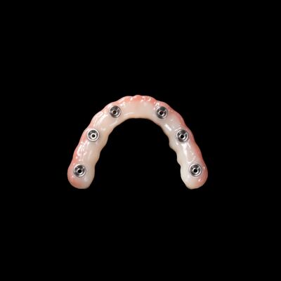 satın al Hemen yüklenme protezlerinin yerleştirilmesi Açık pembe çıkarılabilir yapay dişler online manufacture