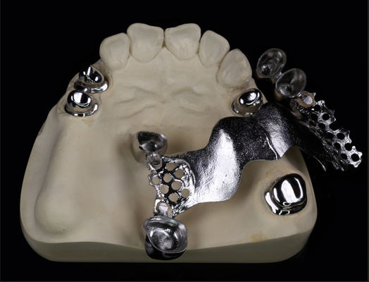 Teleskop Dental ve Ortodontik için Metal Taç ve Köprü