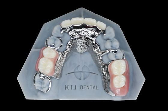 Titanyum Metal Çerçeve Diş protezi çıkarılabilir sahte dişler