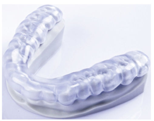 Şeffaf Diş Yumuşak Çubuk 3D Basılı Ortodontik Aygıt