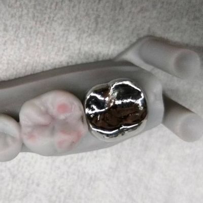 Tam Metal Taç ve Köprü Yüksek Doğruluk Gümüş Geçici Taç