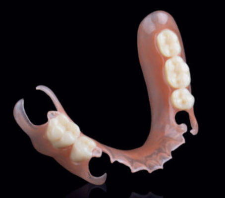 Valplast Esnek Kısmen Alınabilir Diş Dişleri Presiyon Bağlama Prostodontikte