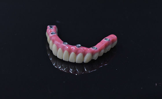Hemen yüklenme protezlerinin yerleştirilmesi Açık pembe çıkarılabilir yapay dişler