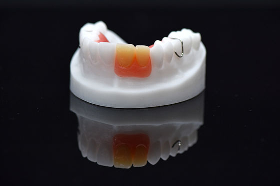 Acrylic Flipper çıkarılabilir Overdenture Özel çıkarılabilir Acrylic Denture
