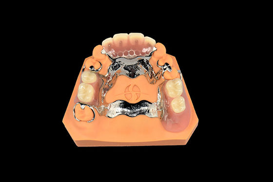 Diş implantları çıkarılabilir diş protezleri Vitallium Metal kısmi diş protezleri