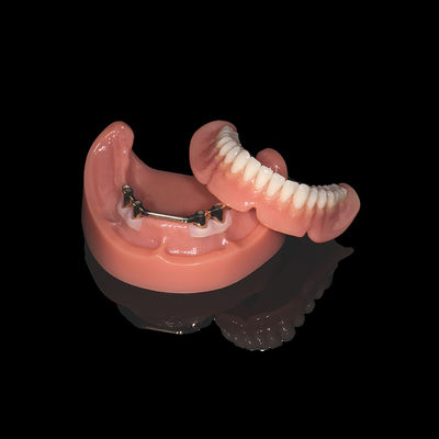 Pembe Titanyum Çubuk Ayrılıklı Diş Dişleri Akrilik Diş Diş Finish