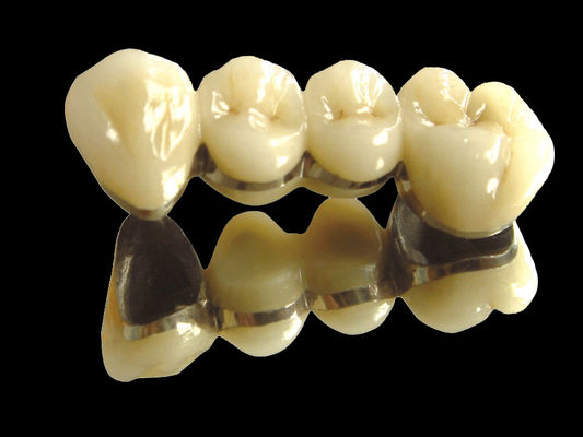 Değerli Metal Köprü İmplantı Taç Köprüsü Kullanım Dayanıklı Özel
